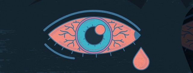 Can Sleep Apnea Lead to Eye Problems? image