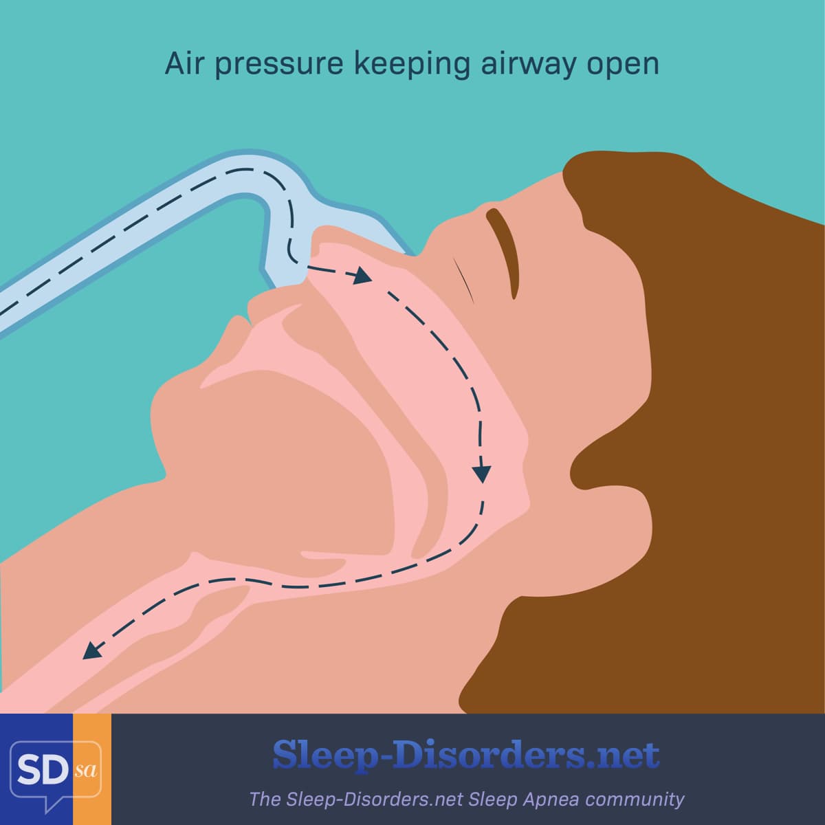 Person wearing CPAP mask, so air flow can keep airway open during sleep