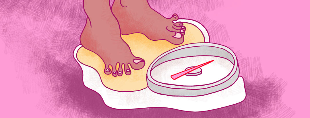 Stopping CPAP After Weight Loss image