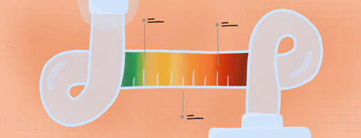 Obstructive Sleep Apnea Severity: A Closer Look image